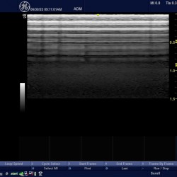 GE Portable Ultrasound LOGIQ e R7 Series Probes  9L-RS  + L8-18i-RS  (2017-02)