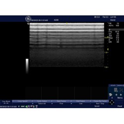 GE Portable Ultrasound LOGIQ e R7 Series Probes  9L-RS  + L8-18i-RS  (2017-02)