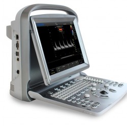Chison Eco5 Portable Ultrasound System