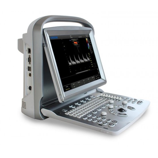 Chison Eco5 Portable Ultrasound System